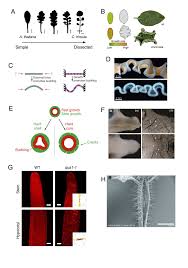 The radial step of microtubules as a pre-preprophase band structure in  plant cell division