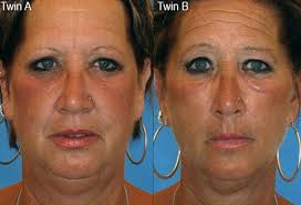 What are the odds of getting cancer from chewing tobacco. Chewing Tobacco Health Effects Cancer Facts How To Quit