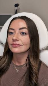 One like and I'll be brave and get my tox without laughing gas 🥲💉 If you  know me you know I'm a chicken and put off my own treatments the most 🙈