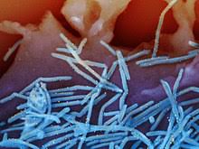 Respiratory syncytial virus, or rsv, is a respiratory virus that infects the lungs and breathing passages. Respiratory Syncytial Virus Wikipedia
