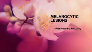 The increase in melanin is often associated with an increase of normal melanocytes at the. Melanocytic Lesions Pathology
