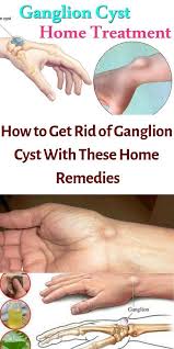 Pin On Healthy Remedies