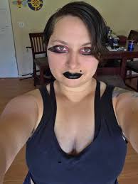 Jaw wired shut but feeling better daily