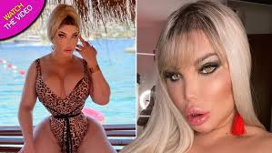 Jessica alves revealed her latest plastic surgery didn't go according to plan. Jessica Alves Says She Feels Born Again After Gender Reassignment Surgery Mirror Online