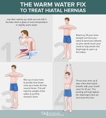 Hiatal Hernia Symptoms Causes And Natural Support Strategies Hernia Exercises Hiatus Hernia Hiatal Hernia Diet