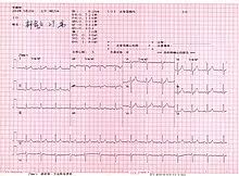 electrocardiography wikipedia