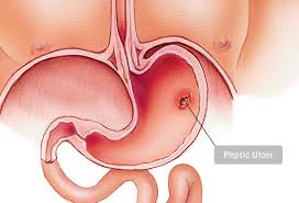 14 Reasons Your Stomach Hurts