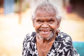 Kunmanara (Wawiriya) Burton