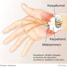 Diphenhydramine is an antihistamine used to relieve symptoms of allergy, hay fever, and the common cold. Periphere Nerven Universitatsklinikum Freiburg