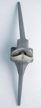 Ce nombre important, et qui a augmenté considérablement ces dernières années, est lié au fait que. Quels Sont Les Differents Types De Prothese De Genou Prothese Articulaire En 100 Questions