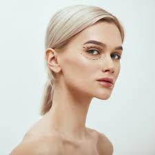 Blepharoplasty Scottsdale, AZ