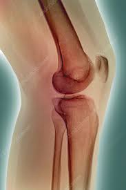 Image result for Knee XRay