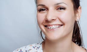 Check spelling or type a new query. Why Do I Need Braces Again
