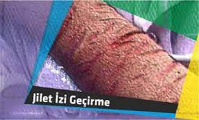 jilet izi gecirme iz