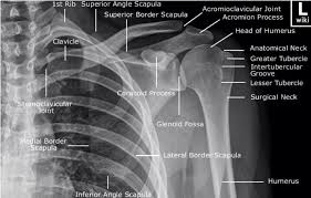 Image result for Shoulder XRay