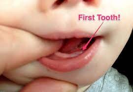 Age 7 Months Old My Chris S First Baby Tooth Nazia And Rukeya First Tooth Teeth 7 Month Milestones
