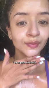 4 meses de amor en mi piel: Procesos con amor… acompañada de una  profesional … Dermatóloga Catalina Santa Vélez 😍 en Medellín #dermatologia  #medellin #acne #tratamiento