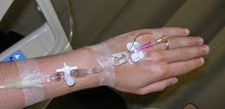 We did not find results for: Cara Cepat Menghitung Tetesan Infus All About Nurse