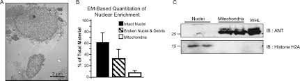 Top suggestions for anatomy mapper. Specialized Compartments Of Cardiac Nuclei Exhibit Distinct Proteomic Anatomy Molecular Cellular Proteomics