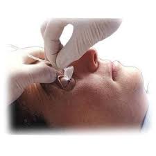 Image result for Eye Irrigation