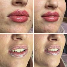 Ju Derma Aesthetics & Cosmetics