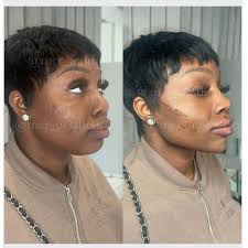 Another amazing glow up by @mcr_aesthetics using only the finest  @caratfill_uk All the way from the USA 🇺🇸 to UK 🇬🇧 . . . . #glowup  #snatched #contouring #nonsurgicalfacelift #nonsurgical #dermalfiller  #fillers #