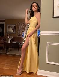 West side story star rachel zegler revealed she discovered a lump in her breast that was benign. 1kivjdomdcoeam