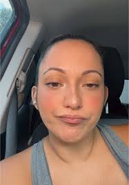 Adhd India Lynn Stacy