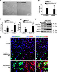 Plant tissue culture involves excising plant tissues and growing them on nutrient media. Smooth Muscle Cells Differentiated From Mesenchymal Stem Cells Are Regulated By Micrornas And Suitable For Vascular Tissue Grafts Journal Of Biological Chemistry