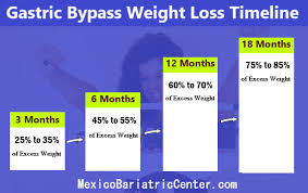 It is best to check with your insurance carrier directly to get detailed information as to what is required to qualify for bariatric surgery. Gastric Bypass Weight Loss Expectations Timeline Plateau