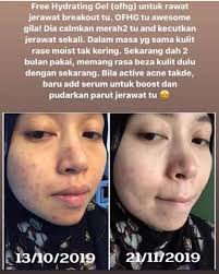 It usually has to be. Testimoni Oil Free Hydrating Gel Mary Wis Beauty Care Facebook