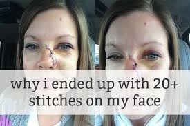 On a Personal Note: What Happened to My Face