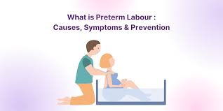 Image result for Preterm Labor Management