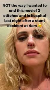 Rebel Wilson (43) met verwondingen naar het ziekenhuis na ongeluk op 'Bride  Hard'-set MovieMeter.nl