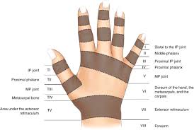 Image result for Hand Extensor Tendon Injury