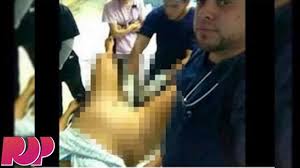 5 kesakitan isteri selepas bersalin. Doktor Bergambar Dengan Wanita Sedang Bersalin Dikenalpasti Mynewshub