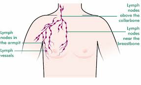 A family history of breast cancer—male or female—puts you at a higher risk than the average dude. Breast Cancer In Men And The Lymphatic System Macmillan Cancer Support