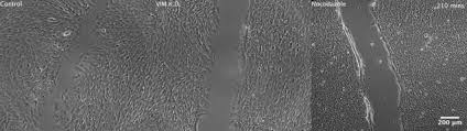 'how long have you been waiting?' 'only for a minute or two.' Vimentin Intermediate Filaments Template Microtubule Networks To Enhance Persistence In Cell Polarity And Directed Migration Sciencedirect