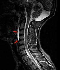 Mri cervical spine and mri shoulder for pain indications. Epos Trade