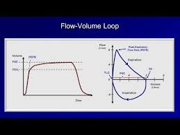 Pulmonary Function Tests Pft Lesson 2 Spirometry Youtube