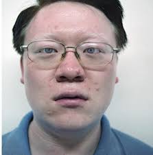 Blonde combed over hair idea for boys. Is It Rare For An Asian To Have Blue Eyes And Blonde Hair Quora