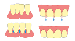Image result for what is orthodontic ic treatment plan