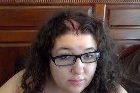 Heels serves as the body's natural (biological) cover and should not be removed. This Is What It Feels Like To Have A Bullet Graze Your Scalp As Told By A Survivor Upvoted