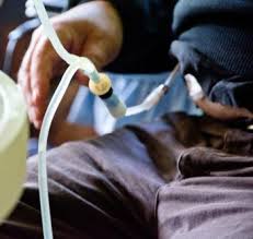 If you get medicare part a (hospital insurance), you can also enroll in medicare part b (medical insurance). Chronic Kidney Disease Symptoms Causes And Treatment