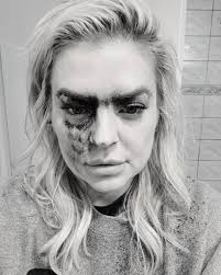 General Hospital' star Kirsten Storms shares photo after freak coffee  accident