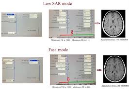 Tr=10ms 3d ir gradient echo. Mri Bandwidth And Image Quality How To Manipulate Transmitter Bandwidth And Receiver Bandwidth Bandwidth And Snr