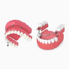Image result for dentures