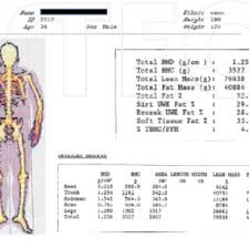 You might choose to work the major muscle groups at a single session two or three. Pdf Causes And Treatment Of Bone And Muscle Conditions Research Collection