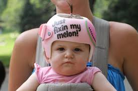 What A Cute Way To Tell Everyone About The Helmet Humans Of New York Baby Helmet Hipster Babies