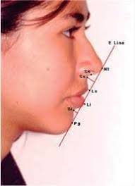 EVALUACION DEL PERFIL FACIAL DE TEJIDOS BLANDOS CON EL ANALISIS DE POWELL  EN 364 ESCOLARES DE 6 A 13 AÑOS CON CLASE I MOLAR DE